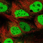 Immunofluorescent staining of human cell line CACO-2 shows localization to nucleoplasm & cytosol.