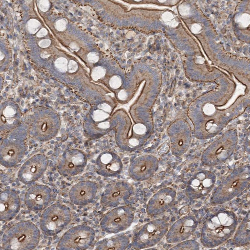 Anti-SH3BP5L Antibody