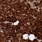 Immunohistochemical staining of human pancreas shows strong cytoplasmic positivity in exocrine glandular cells.