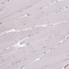 Immunohistochemical staining of human skeletal muscle shows no positivity in myocytes as expected.