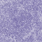 Immunohistochemical staining of human tonsil shows no positivity in non-germinal center cells as expected.
