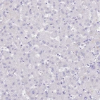 Immunohistochemical staining of human liver shows no positivity in hepatocytes as expected.