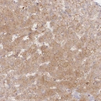 Anti-GBE1 Antibody
