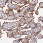 Immunohistochemical staining of human placenta shows strong membranous positivity in trophoblastic cells.