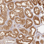 Immunohistochemical staining of human kidney shows strong cytoplasmic positivity in cells in tubules.