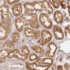 Immunohistochemical staining of human kidney shows strong cytoplasmic positivity in cells in tubules.