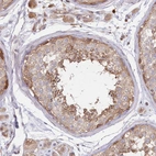 Immunohistochemical staining of human testis shows strong cytoplasmic and membranous positivity in cells in seminiferous ducts.