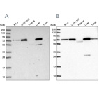 Western blot analysis using Anti-GBE1 antibody HPA038073 (A) shows similar pattern to independent antibody HPA038074 (B).