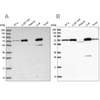 Western blot analysis using Anti-GBE1 antibody HPA038073 (A) shows similar pattern to independent antibody HPA038074 (B).