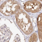 Immunohistochemical staining of human kidney using Anti-GBE1 antibody HPA038074.