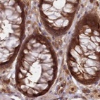 Immunohistochemical staining of human colon using Anti-GBE1 antibody HPA038075.
