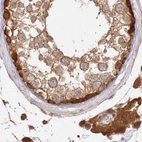 Immunohistochemical staining of human testis using Anti-GBE1 antibody HPA038074.