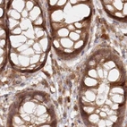 Immunohistochemical staining of human colon using Anti-GBE1 antibody HPA038074.