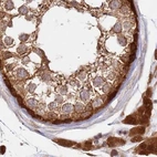 Immunohistochemical staining of human testis using Anti-GBE1 antibody HPA038075.