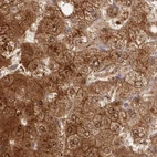 Immunohistochemical staining of human liver using Anti-GBE1 antibody HPA038074.