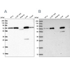 Western blot analysis using Anti-GBE1 antibody HPA038074 (A) shows similar pattern to independent antibody HPA038073 (B).