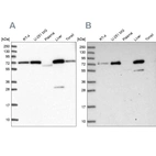 Western blot analysis using Anti-GBE1 antibody HPA038074 (A) shows similar pattern to independent antibody HPA038073 (B).