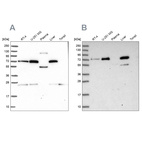 Western blot analysis using Anti-GBE1 antibody HPA038075 (A) shows similar pattern to independent antibody HPA038073 (B).