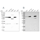Western blot analysis using Anti-GBE1 antibody HPA038075 (A) shows similar pattern to independent antibody HPA038073 (B).