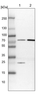Lane 1: NIH-3T3 cell lysate (Mouse embryonic fibroblast cells)_br/_Lane 2: NBT-II cell lysate (Rat Wistar bladder tumour cells)
