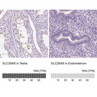 Anti-SLC26A8 Antibody