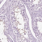 Immunohistochemical staining of human testis shows high expression.