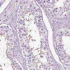 Immunohistochemical staining of human testis shows high expression.