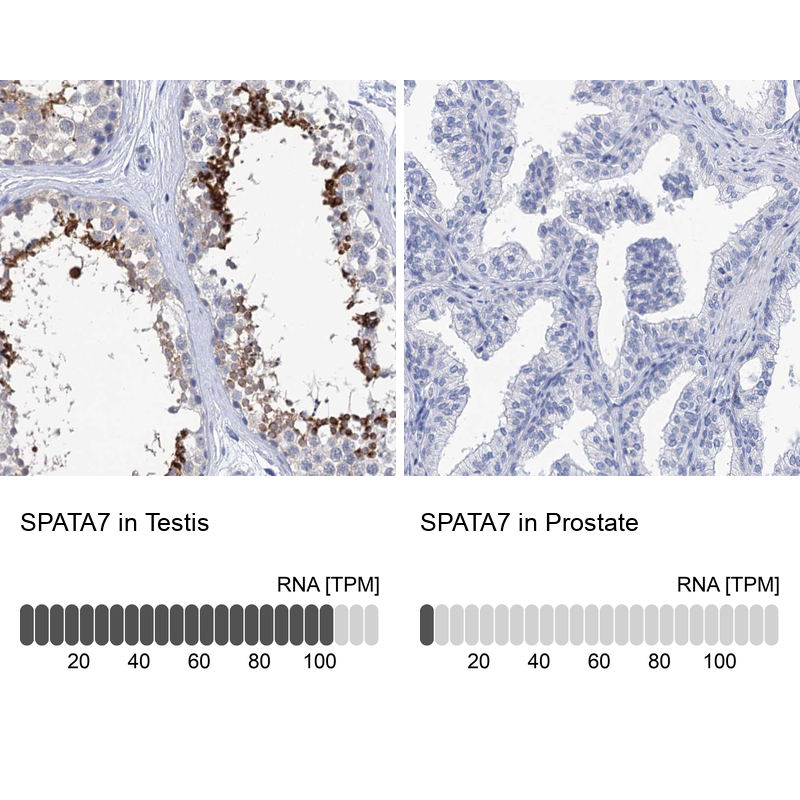 Anti-SPATA7 Antibody