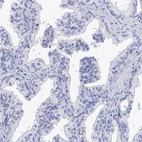 Immunohistochemical staining of human prostate shows low expression as expected.
