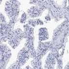 Immunohistochemical staining of human prostate shows low expression as expected.