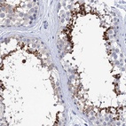 Immunohistochemical staining of human testis shows high expression.