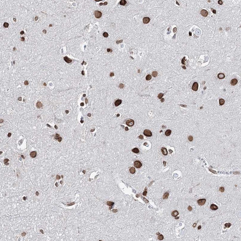 Anti-KIAA0930 Antibody