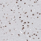 Anti-KIAA0930 Antibody