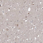 Immunohistochemical staining of human cerebral cortex shows moderate granular cytoplasmic positivity in neurons.