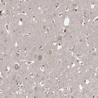 Immunohistochemical staining of human cerebral cortex shows moderate granular cytoplasmic positivity in neurons.