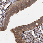 Immunohistochemical staining of human fallopian tube shows strong granular cytoplasmic positivity in glandular cells.