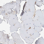 Immunohistochemical staining of human skeletal muscle shows no positivity in myocytes as expected.