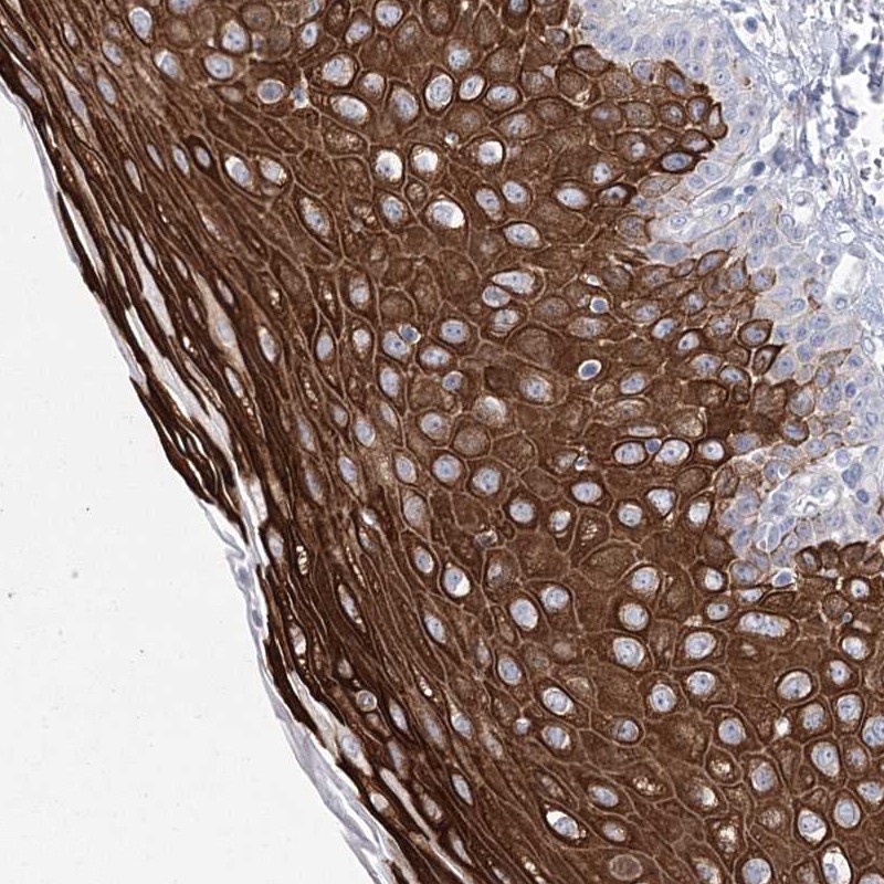 Anti-CCDC88A Antibody