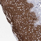 Anti-CCDC88A Antibody