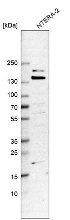 Western blot analysis in human cell line NTERA-2.