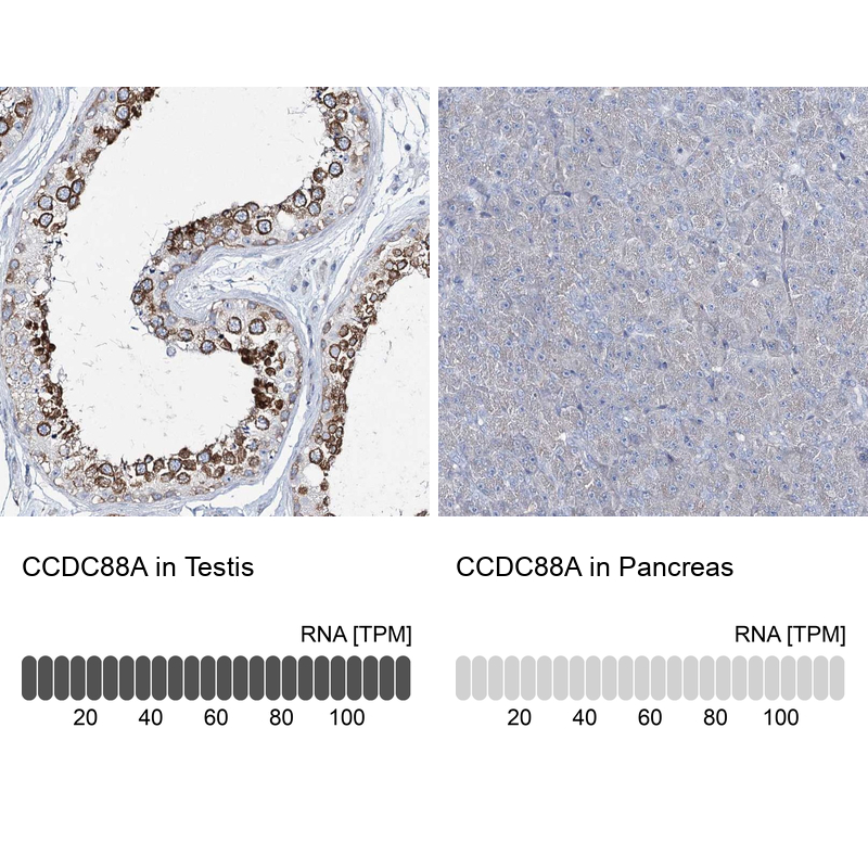 Anti-CCDC88A Antibody