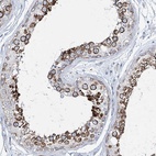 Anti-CCDC88A Antibody