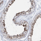 Immunohistochemical staining of human testis shows high expression.