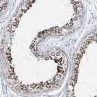 Immunohistochemical staining of human testis shows high expression.