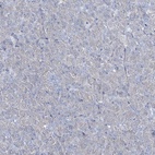 Immunohistochemical staining of human pancreas shows low expression as expected.