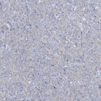 Anti-CCDC88A Antibody