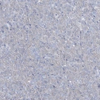Immunohistochemical staining of human pancreas shows low expression as expected.