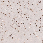 Anti-FAM13A Antibody