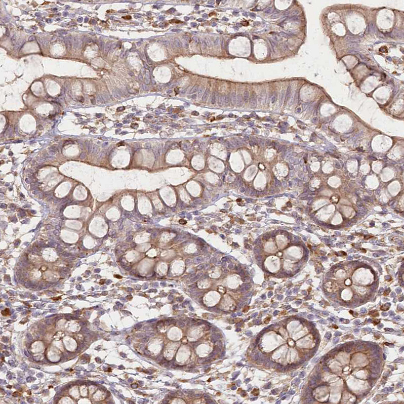 Anti-FAM13A Antibody