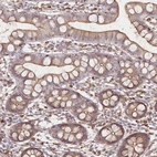 Anti-FAM13A Antibody